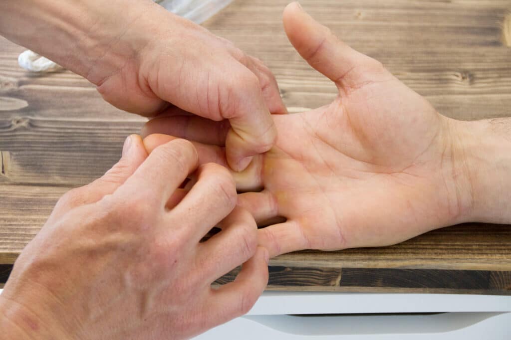 Isele-Methode Fingerbehandlung in der Therapierbar Bregenz