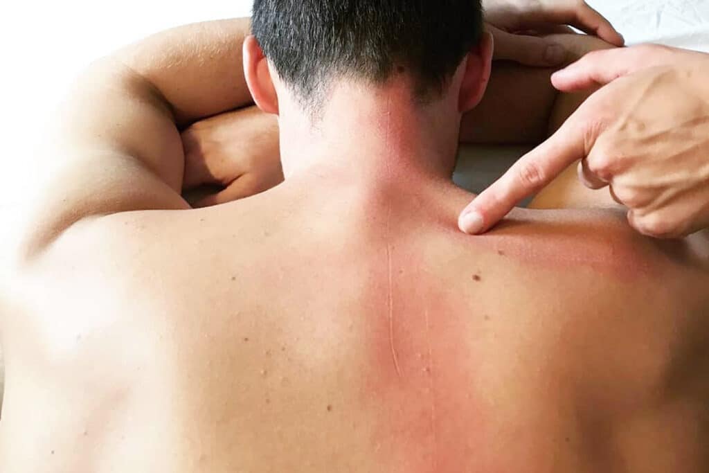 FDM Therapierbar Academy Rückenbehandlung